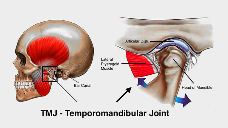 Image representing TMJ Therapy